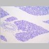 Pancreas SF 03.jpg